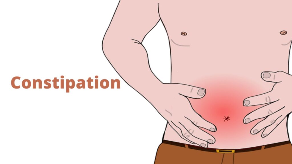 Constipation Puns and Jokes for Adults